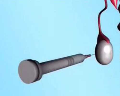 移植后要注意的都在这里  能代生的公司移植冻胚注意事项