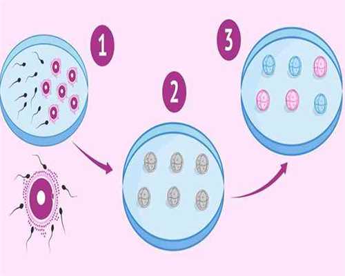 试管婴儿花钱吗：做试管婴儿费用助孕干