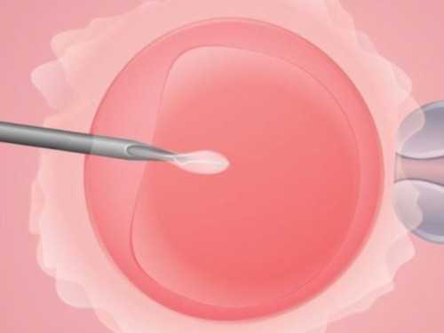 婴儿口腔溃疡护理,婴儿口腔溃疡原因