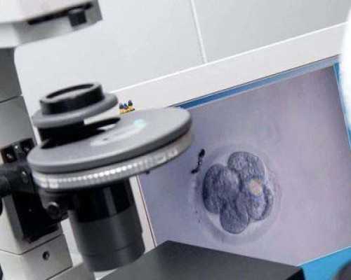 13号14号染色体罗氏易位什么导致的？